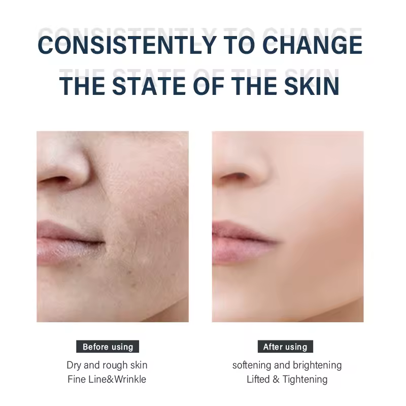 Sheep Placenta Sheet Mask - view 6