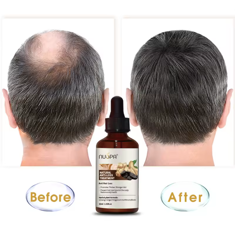 Ginger Anti Hair Loss Growth Hair Oil - view 2