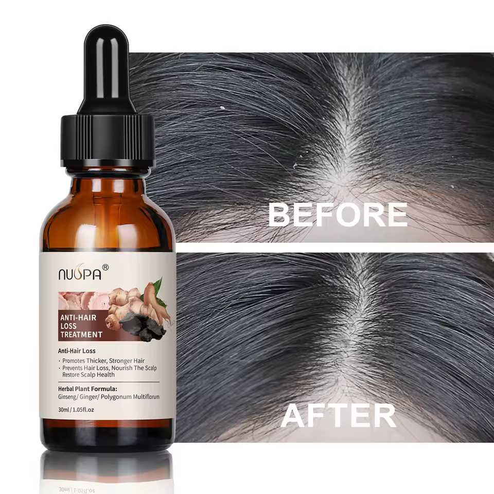 Ginger Anti Hair Loss Growth Hair Oil - view 6